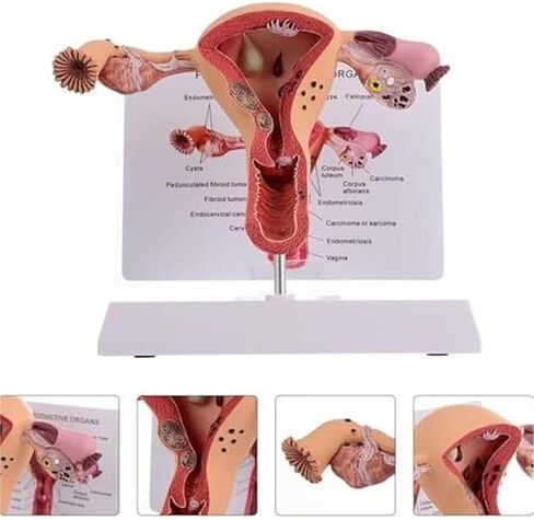 Female Reproductive Organs, Pathological Uterus, Human Anatomy Models, School Teaching Demonstration Tools in Kuwait