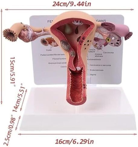 Female Reproductive Organs, Pathological Uterus, Human Anatomy Models, School Teaching Demonstration Tools in Kuwait