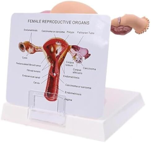 Female Reproductive Organs, Pathological Uterus, Human Anatomy Models, School Teaching Demonstration Tools in Kuwait