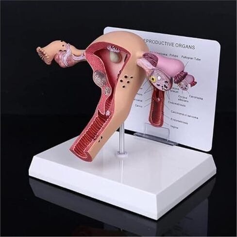 Female Reproductive Organs, Pathological Uterus, Human Anatomy Models, School Teaching Demonstration Tools in Kuwait
