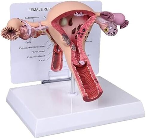 Female Reproductive Organs, Pathological Uterus, Human Anatomy Models, School Teaching Demonstration Tools in Kuwait