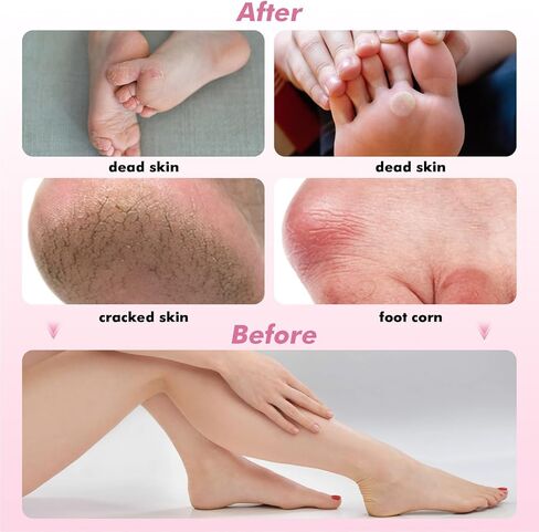 2 in1 Electric Foot Callus Remover Waysse Callus Remover for Feet with Replacement Sandpaper Discs, Adjustable Speed Electric Foot File Professional Pedicure Tool for Dead Skin Calluses in Saudi Arabia