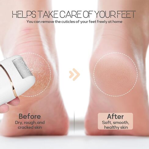 Electric Foot File and Callus Remover, Rechargeable Pedicure Device with Multiple Heads for Dry Rough Feet Care, Home Use Foot Grinder Tool in Saudi Arabia