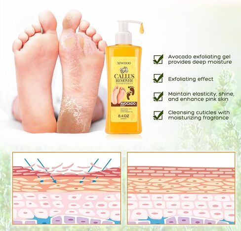 Foot Callus Remover Gel Kit Heel Exfoliator Dead Skin Remover Pedicure Foot Spa Products Set Home Pedicure Foot Care Spa Supplies for Rough, Dry, Cracked Skin Cracked Heel, Professional in Kuwait