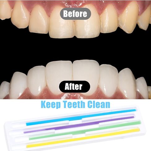 60Pcs Dental Polishing Strips 4mm x 150mm Dental Polisher Teeth Sanding Grinding Deep Finishing Tooth File Universal Dentals Abrasive Strips Tooth Polish Abrasive Strip for Oral Care Cleaning in Kuwait