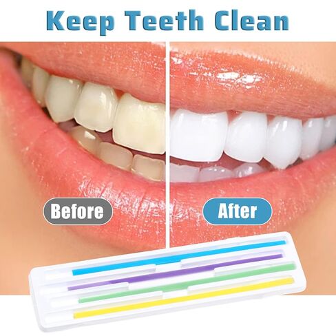 80Pcs Dental Polishing Strips Teeth Polishing Finishing Teeth Sanding Grinding Tool Kit Dental Polish Abrasive Strip 4mm x 150mm Finishing Tooth File Deep Tooth Cleaning for Oral Care Gloss Contouring in Kuwait