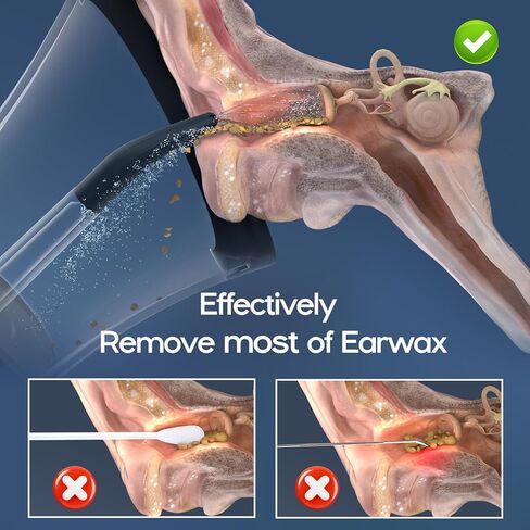 Ear Wax Removal, Electric Ear Cleaning Kit Effective & Safe Ear Cleaner Irrigation Flushing System 4 Pressure Modes for Ear Wax Buildup, Water Resistant Ear Cleaning Tool USB Rechargeable in Kuwait