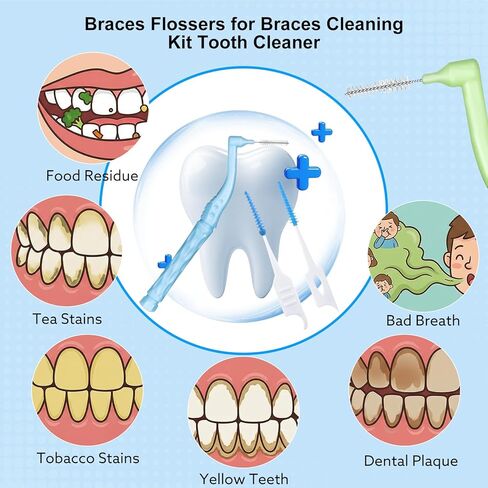230 PCS Braces Brush, interdental Brushes Between Teeth Soft Dental Floss Picks Toothpicks Dental Brush Braces Flossers for Braces Cleaning Kit Tooth Cleaner Tool with case(Bright Colors) in Kuwait