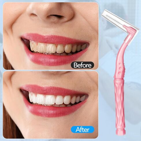 230 PCS Braces Brush, interdental Brushes Between Teeth Soft Dental Floss Picks Toothpicks Dental Brush Braces Flossers for Braces Cleaning Kit Tooth Cleaner Tool with case(Bright Colors) in Kuwait