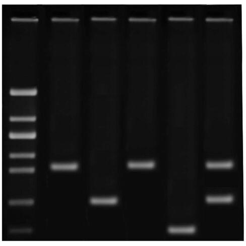 DNA Fingerprinting Using PCR for 25 Students Working in 5 Groups in Saudi Arabia