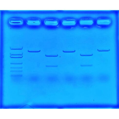 Using CRISPR to Treat Cystic Fibrosis for 8 Gels in Saudi Arabia