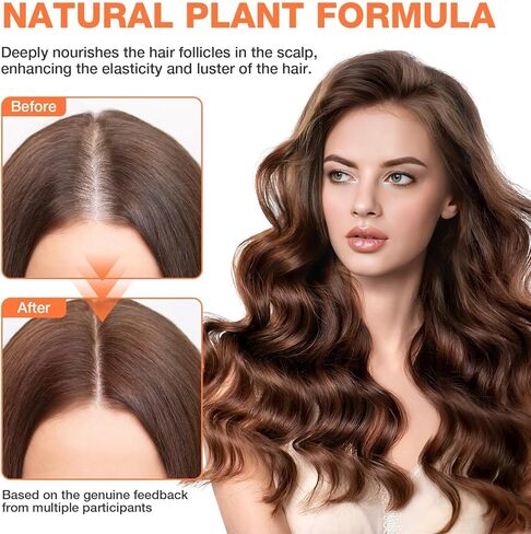 Pumpkin Seed Oil with Saw Palmetto Capsules 300 Softgels - 3000mg Max Strength, Cold-Pressed, Supports Hair, Urinary, Bladder & Prostate Health, Boosts Immunity, Non-GMO in Kuwait