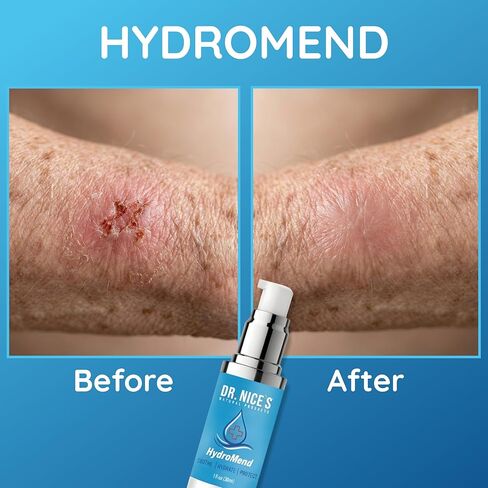 DR. NICE'S HydroMend for Seniors | for Chronic Wounds, Thin, Fragile or Dry Skin, Minor Cuts, Bumps and Bruises, Scrapes, Wounds, Chafe, Burns | Topical First-aid Hydrogel (30 ML) in Saudi Arabia