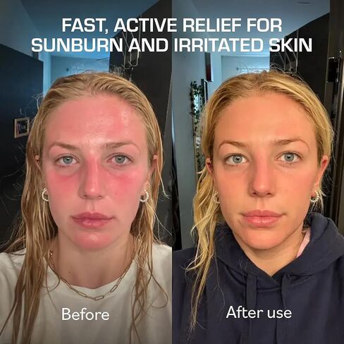 TERNS Mayday Intensive After Sun Gel Cream, Cooling Skin Care for Sunburn Relief, 3X Marine Bioactive Complex with Niacinamide, Squalane, Shea Butter & Aloe, Travel Size, Fragrance Free, 2 Fl Oz in Kuwait