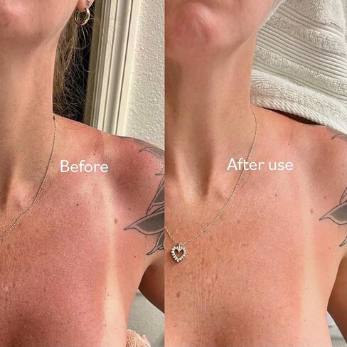 TERNS Mayday Intensive After Sun Gel Cream, Cooling Skin Care for Sunburn Relief, 3X Marine Bioactive Complex with Niacinamide, Squalane, Shea Butter & Aloe, Travel Size, Fragrance Free, 2 Fl Oz in Kuwait