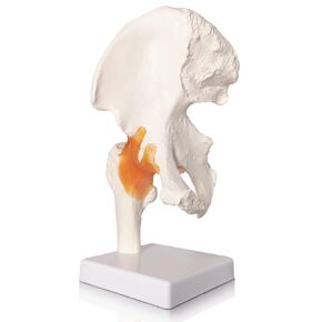 Evotech Hip Joint Model with Muscles, Human Body Anatomy Replica of Normal Muscled Hip Bone for Doctors Office Educational Tool
