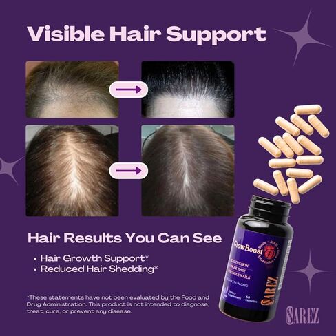 معزز الكولاجين ساريز جلو بوست - MSM، سيليكا الخيزران، أستازانتين، الرمان، البيوتين وبذور العنب - يدعم إنتاج الكولاجين وحمايته، تجديد البشرة، قوة الشعر والأظافر - كمية تكفي 30 يومًا in Kuwait