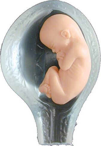 Fetal Model, Touch of Life, in The Womb, White in Saudi Arabia