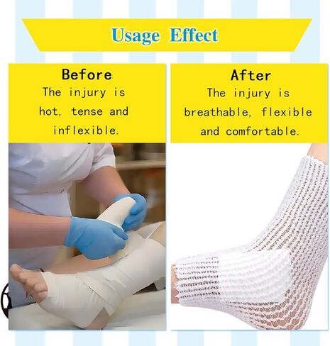 2 ضمادة أنبوبية ملفوفة، حزام أنبوبي لتثبيت الضمادات، أنبوب ستوكينيت من الشاش الأنبوبي للساقين، شبكة مطاطية للعناية بالجروح دون استخدام شريط لاصق (مقاسان) in Kuwait