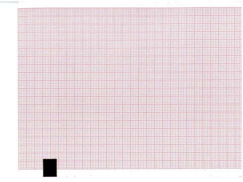 ورق EEG مقاس 110 مم × 140 مم × 142 ورقة (يعمل مع FUKUDA OP-222TE، FX 7202، EDAN SE 601 Series، SE-601A، SE-601، SE-601C، Cardio TECH CRT-6، SE-601B، EDAN SE-3، SPACELABS SL6، Advanced ECG-6) (10) in Kuwait