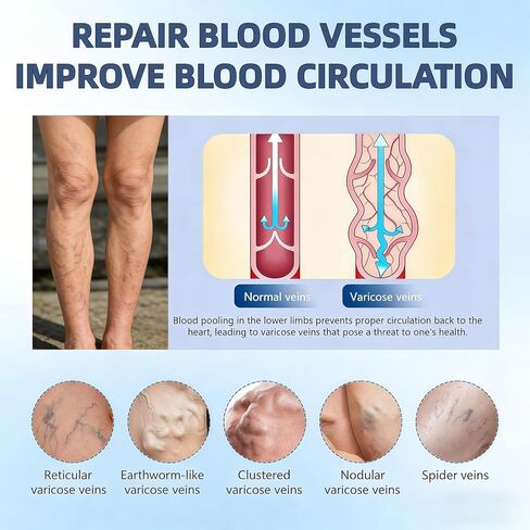 رقعة Vein Target Microdarts، 2026 علاج احترافي جديد لدوالي الأوردة لرقعة الساقين، وتخفيف إزعاج الساق، وتحسين الدورة الدموية، وعلاج الساق بالمكونات الطبيعية لجميع أنواع البشرة. in Kuwait