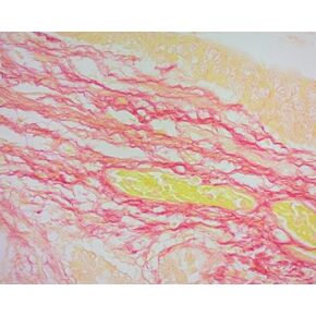 محلول بيكروسيريوس الأحمر، 1000 مل in Kuwait