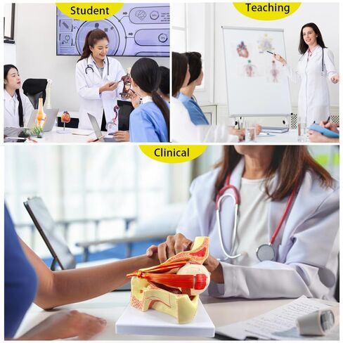 3X Enlarged Human Eye Orbital Anatomy Model with Stand, 10 Detachable Anatomical Parts Eyeball Orbit Model for Teaching and Ophthalmology Study in Kuwait