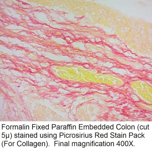 محلول بيكروسيريوس الأحمر، 1000 مل in Kuwait