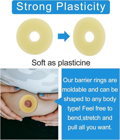 10 PCS Ostomy Barrier Rings - 2mm Thickness Medical Grade Hydrocolloid, Moldable Skin Extender Rings for Leak Prevention, Sensitive Skin, Fits All Ostomy Bags (2 inch Diameter) in Saudi Arabia