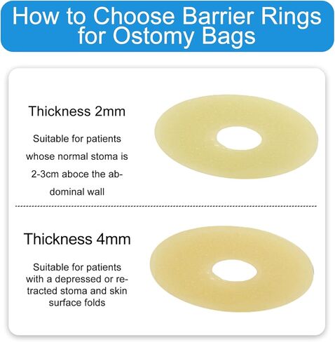 10 PCS Ostomy Barrier Rings - 2mm Thickness Medical Grade Hydrocolloid, Moldable Skin Extender Rings for Leak Prevention, Sensitive Skin, Fits All Ostomy Bags (2 inch Diameter) in Saudi Arabia