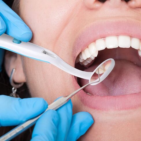 4 قطع من مرايا الأسنان من هيليفتي مع ضوء LED أدوات فحص العناية بالفم المحمولة ومضادة للضباب بزاوية منحنية للأسنان للاستخدام المنزلي والمهني، 5.90 × 1.10 × 0.59 بوصة in Saudi Arabia