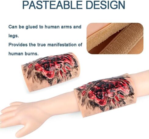 Limb Burn Training Module, 3-4 Degree Simulation Model, Wearable Care Skin, Teaching Demonstration, for Medical Students Practice Exercises in Saudi Arabia