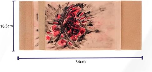 Limb Burn Training Module, 3-4 Degree Simulation Model, Wearable Care Skin, Teaching Demonstration, for Medical Students Practice Exercises in Saudi Arabia