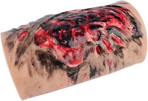 Limb Burn Training Module, 3-4 Degree Simulation Model, Wearable Care Skin, Teaching Demonstration, for Medical Students Practice Exercises in Saudi Arabia