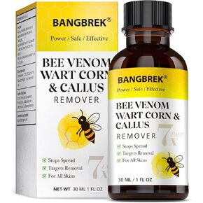 مزيل ثآليل سم النحل: مزيل ثآليل سريع المفعول يتجمد من أجل مزيلات مسامير القدم المسطحة الشائعة الأخمصية لأصابع القدمين - مزيلات مسامير القدم من حمض الساليسيليك بقوة قصوى (1 أونصة سائلة)) in Kuwait