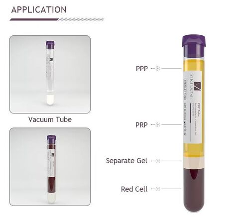 مجموعة PRP مع جل فصل أنابيب سعة 12 مل ومجموعة كاملة من مضادات التخثر (مجموعة + 24 أنبوبًا) in Kuwait
