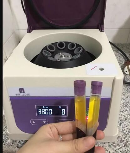 مجموعة PRP مع جل فصل أنابيب سعة 12 مل ومجموعة كاملة من مضادات التخثر (مجموعة + 24 أنبوبًا) in Kuwait