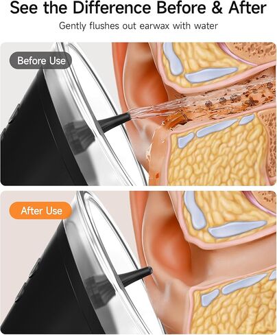 Renergy Electric Ear Wax Removal Kit with LED Display, Powered Ear Wax Remover, Dual Clean & Waste Tank, Water Ear Cleaner & Ear Cleaning Kit, Ear Irrigation Flushing System, 3 Modes, 12 Nozzles, IP67 in Kuwait