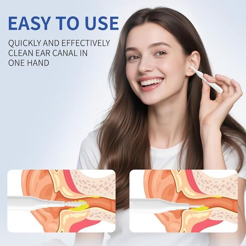 أداة إزالة شمع الأذن، منظف الأذن الحلزوني متعدد الوظائف، أداة تنظيف شمع الأذن Q Grips مع 9 نصائح بديلة، مجموعة إزالة شمع الأذن قابلة للغسل للتنظيف العميق للأذن in Kuwait