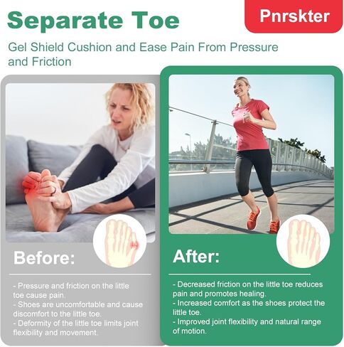 20pcs Pinky Toe Protector Women, Gel Toe Caps, Open Toe Sleeves, Breathable Toe Cushions for Blisters, Corns, Hammer Toes, Toenails Loss (Infused with Aloe Vera Extract) in Kuwait