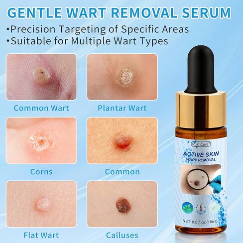 Salicylic Acid Wart Remover for Face & Body - Fast Acting Skin Tag Remover with Precision Dropper, Targets for Corns, Flat, Plantar & Common Warts, Gentle Formula, Travel Size (0.5FL.OZ) in Kuwait