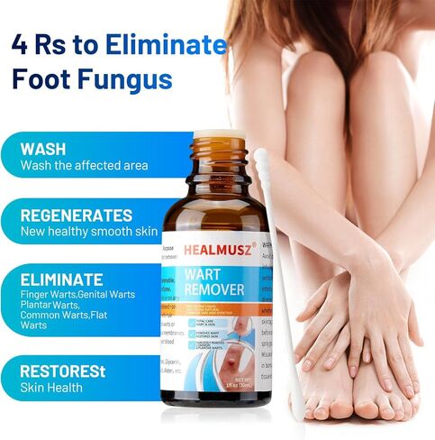 سائل مزيل الثآليل والذرة من هيلموس، 5% حمض الساليسيليك لإزالة الثآليل التناسلية بسرعة على القدمين والقدمين، أفضل منتجات الإزالة الليلية للرجال والأطفال. in Kuwait