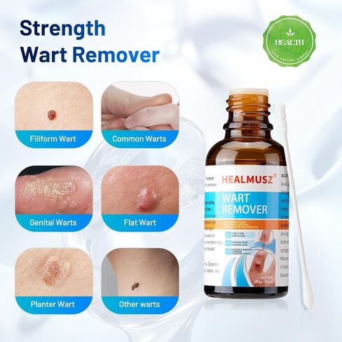 سائل مزيل الثآليل والذرة من هيلموس، 5% حمض الساليسيليك لإزالة الثآليل التناسلية بسرعة على القدمين والقدمين، أفضل منتجات الإزالة الليلية للرجال والأطفال. in Kuwait