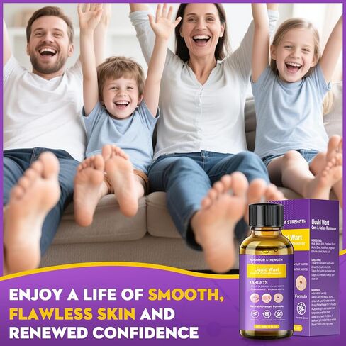 مزيل الثآليل، مجموعة فعالة لإزالة علامات الجلد، إزالة لطيفة للثآليل الشائعة، والثآليل الأخمصية، والذرة والنسيج، سريع المفعول للرجال والنساء (30 مل) in Kuwait