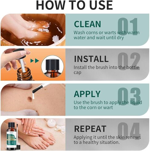 ELEFOCUS Wart Remover Liquid - 12% Wart Liquid with Salicylic Acid - Fast Acting Wart Freeze Off，for Warts, Plantar Wart, Genital Wart, Common Wart, Flat Wart, Corn, Callus 20ml in Saudi Arabia
