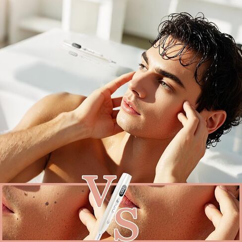 مجموعة إزالة علامات الجلد، GCS-79 – مجموعة أدوات تجميل مدمجة مصممة للعناية بالبشرة في المنزل in Kuwait