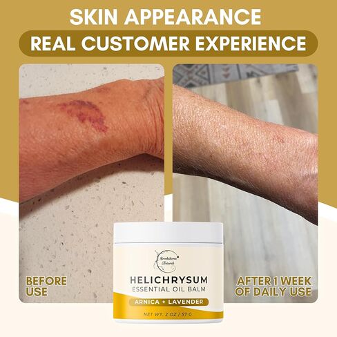 بروكثورن ناتشورالز بلسم الهيليكريسوم | بلسم زيت الهيليكريسوم العطري عالي التركيز للبشرة الهشة | أرنيكا مونتانا، زيت الخروع واللافندر | 2 أوقية in Kuwait