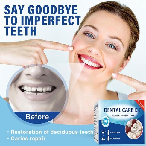 طقم إصلاح الأسنان، طقم استبدال الأسنان المؤقتة، طقم أسنان أسمنت الأوجينول من أكسيد الزنك للأسنان المكسورة والأسنان المفقودة وحشوات التاج والجسور، تحسين الابتسامة 4 قطع in Kuwait