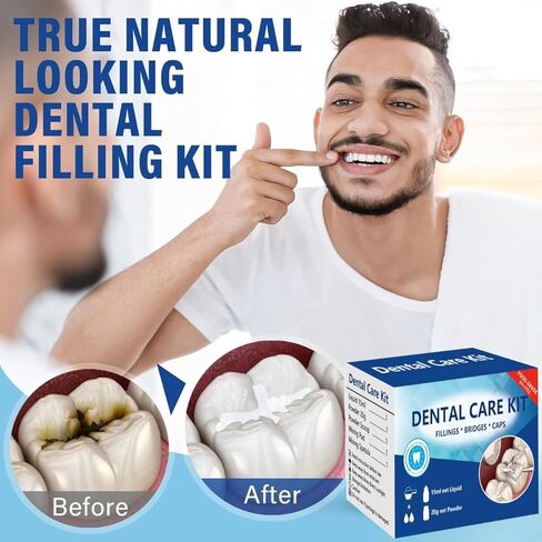 طقم إصلاح الأسنان، طقم استبدال الأسنان المؤقتة، طقم أسنان أسمنت الأوجينول من أكسيد الزنك للأسنان المكسورة والأسنان المفقودة وحشوات التاج والجسور، تحسين الابتسامة 4 قطع in Kuwait