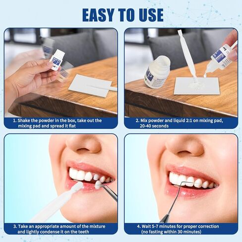 طقم إصلاح الأسنان، طقم استبدال الأسنان المؤقتة، طقم أسنان أسمنت الأوجينول من أكسيد الزنك للأسنان المكسورة والأسنان المفقودة وحشوات التاج والجسور، تحسين الابتسامة 4 قطع in Kuwait